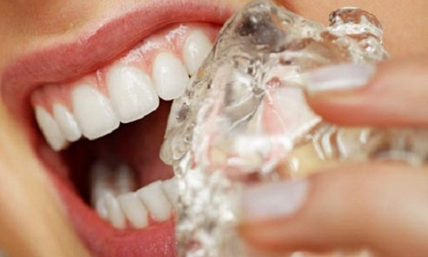 hiện tượng răng bị nứt nên làm gì, răng bị nứt, răng bị nứt có tự lành, răng bị nứt nhẹ, răng bị nứt vỡ, răng bị nứt nên làm gì, hiện tượng răng bị nứt, răng bị nứt đôi, tại sao răng bị nứt, răng bị nứt có sao không, răng bị nứt phải làm sao, răng bị nứt có trám được không, răng bị nứt chân, răng bị nứt có lành lại không, răng bị nứt nẻ, răng bị nứt làm sao, răng bị rạn nứt, chân răng bị nứt, xử lý răng bị nứt, cách điều trị răng bị nứt, cách khắc phục răng bị nứt, nguyên nhân răng bị nứt