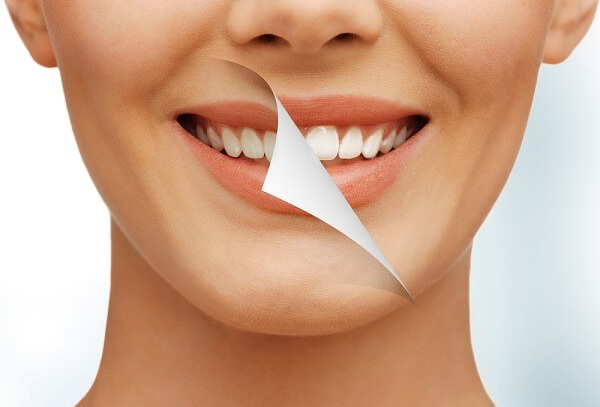 lưu ý tẩy trắng răng, lưu ý khi tẩy trắng răng, lưu ý sau khi tẩy trắng răng,lưu ý khi tẩy trắng răng tại nhà,những lưu ý khi tẩy trắng răng, những lưu ý khi tẩy trắng răng tại nhà, lưu ý trước khi tẩy trắng răng,tẩy trắng răng, giá tẩy trắng răng, có nên tẩy trắng răng, cách tẩy trắng răng tại nhà, những điều cần lưu ý sau khi tẩy trắng răng, lưu ý khi đi tẩy trắng răng, các lưu ý khi tẩy trắng răng, cần lưu ý khi tẩy trắng răng 