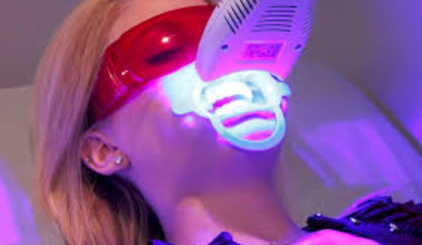 Tẩy trắng răng Laser Whitening có tốt không?