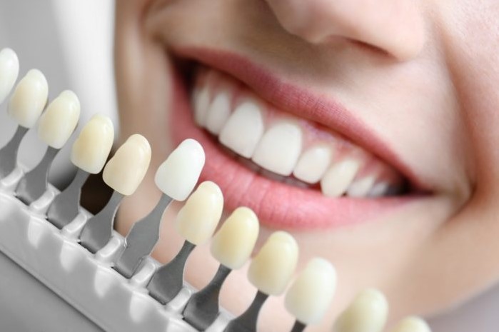  bọc sứ răng hàm, bọc sứ răng hàm trên, bọc sứ răng hàm mặt, quy trình bọc sứ răng hàm