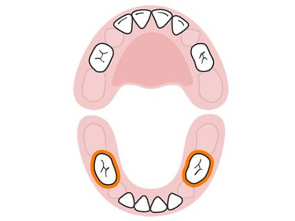 bé mọc răng hàm, sốt mọc răng hàm kéo dài bao lâu, bé mọc răng hàm trong bao lâu, bé mọc răng hàm không chịu ăn, giảm đau cho bé mọc răng hàm, bé sốt mọc răng hàm mấy ngày, bé mọc răng hàm bị đau, bé mọc răng hàm bỏ ăn, dấu hiệu bé mọc răng hàm, khi nào bé mọc răng hàm, biểu hiện bé mọc răng hàm, bé mọc răng hàm biếng ăn, bé mọc răng hàm khóc đêm, mấy tuổi bé mọc răng hàm, trẻ 5 tuổi mọc răng hàm, dấu hiệu trẻ mọc răng, trẻ 6 tuổi mọc răng hàm bị sốt 